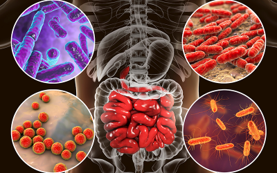 Ce este disbioza? Diagnosticare și tratament pentru boli digestive