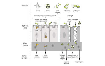 LEGĂTURA DINTRE INTESTINUL PERMEABIL, MICROBIOTĂ ȘI ALERGII