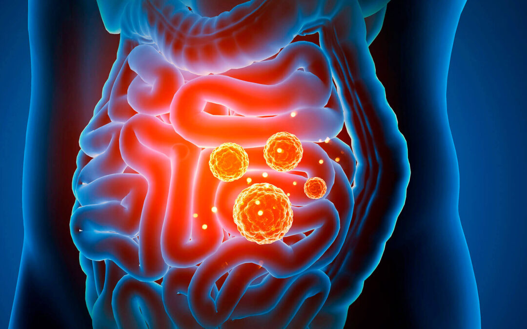 Test de microbiom. Cum te poate ajuta să-ți recapeți starea de sănătate 